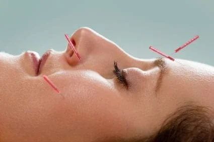 استفاده از تحریکات الکتریکی در برگشت فلج صورت