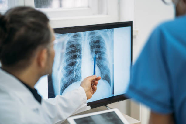 X-Ray